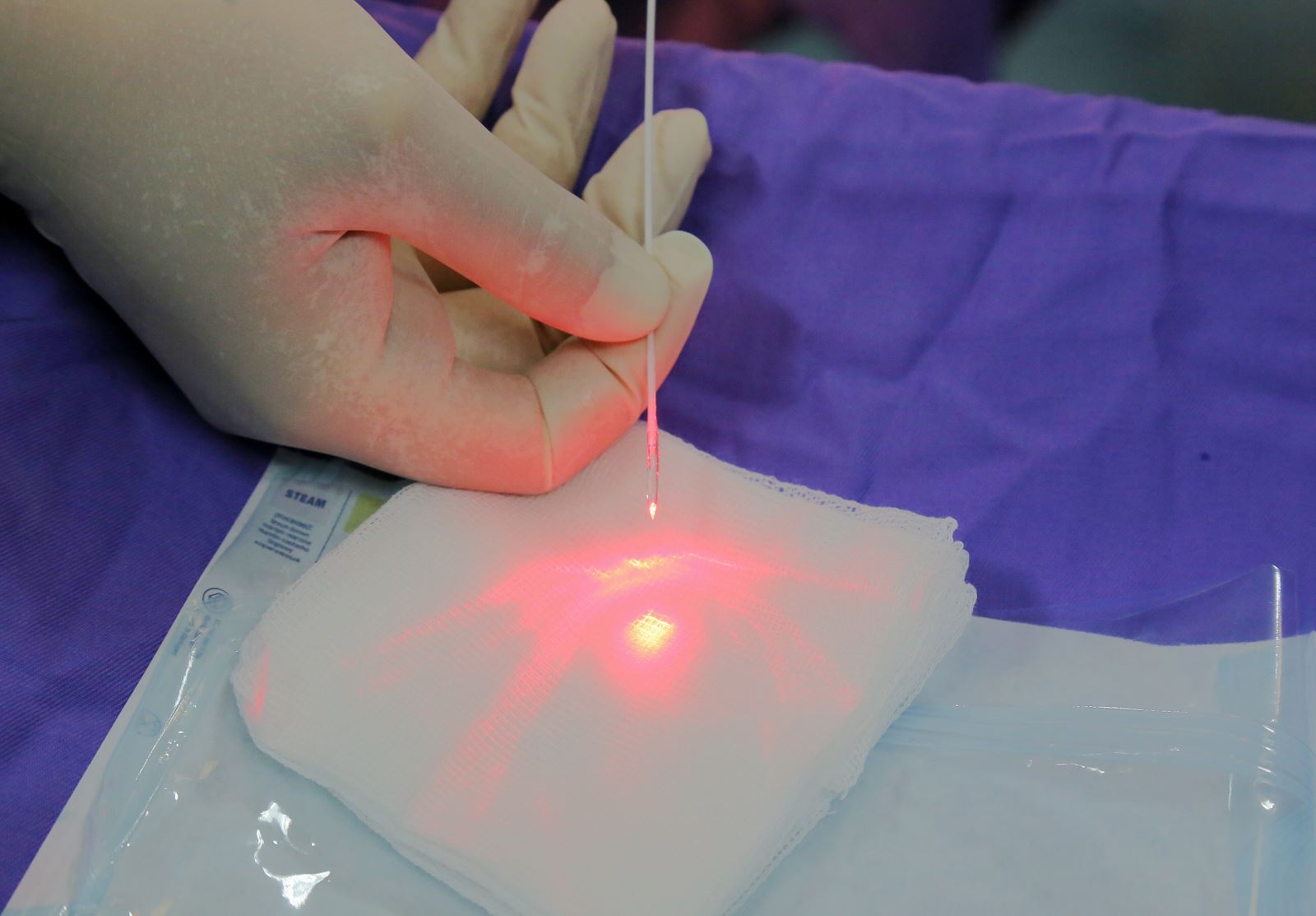 Những ưu điểm nổi bật của phương pháp chữa trĩ bằng laser